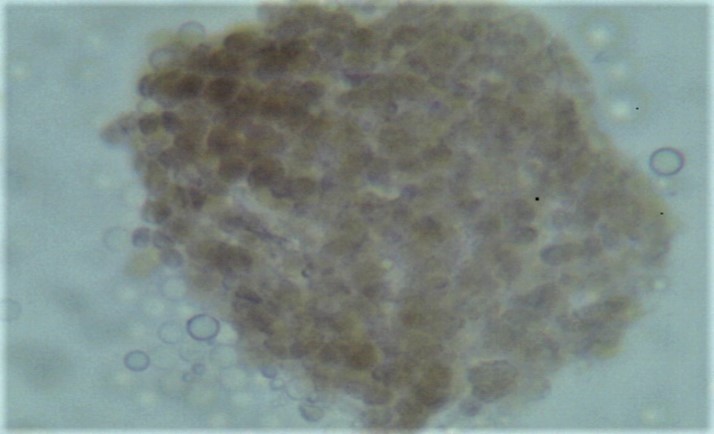 Plasmodio con quistes dentro